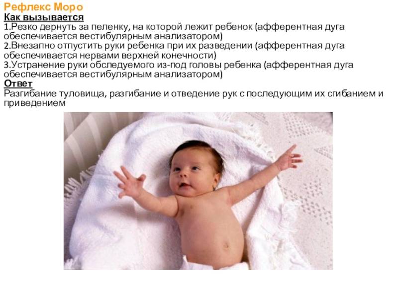 Рефлекс моро у новорожденных: границы нормы и патологии