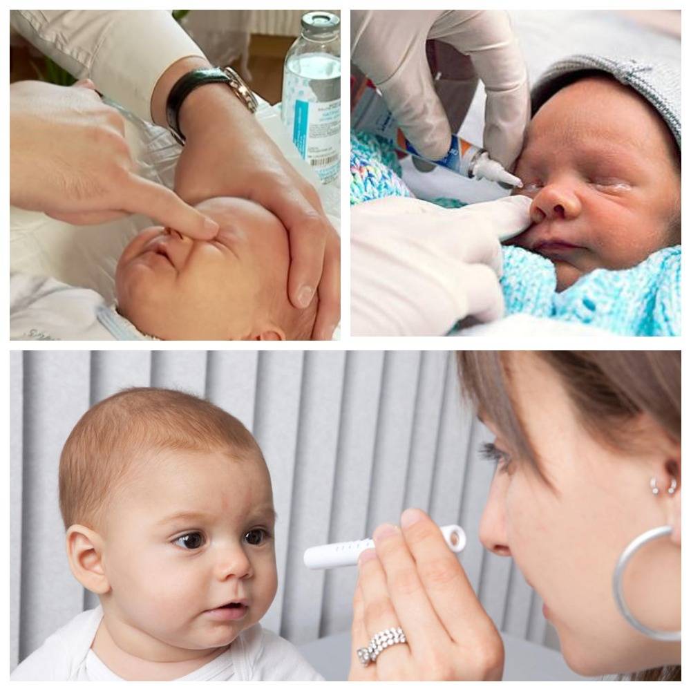 Зондирование слезного канала у новорожденных - как проводится у детей до года, как делают у грудничков и младенцев, что это такое