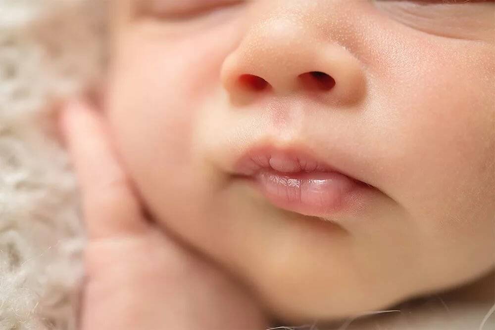 Молочница во рту у детей (+фото): симтомы и лечение – напоправку – напоправку