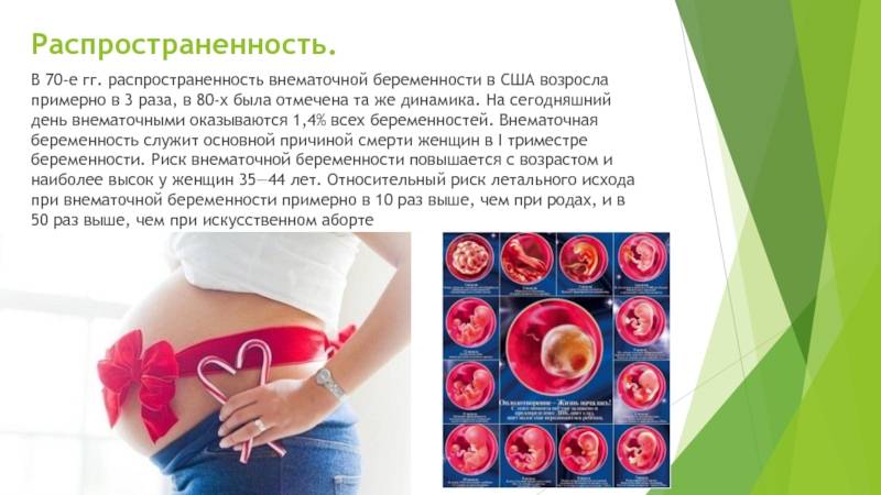 Внематочная беременность: чем опасна и как распознать * клиника диана в санкт-петербурге