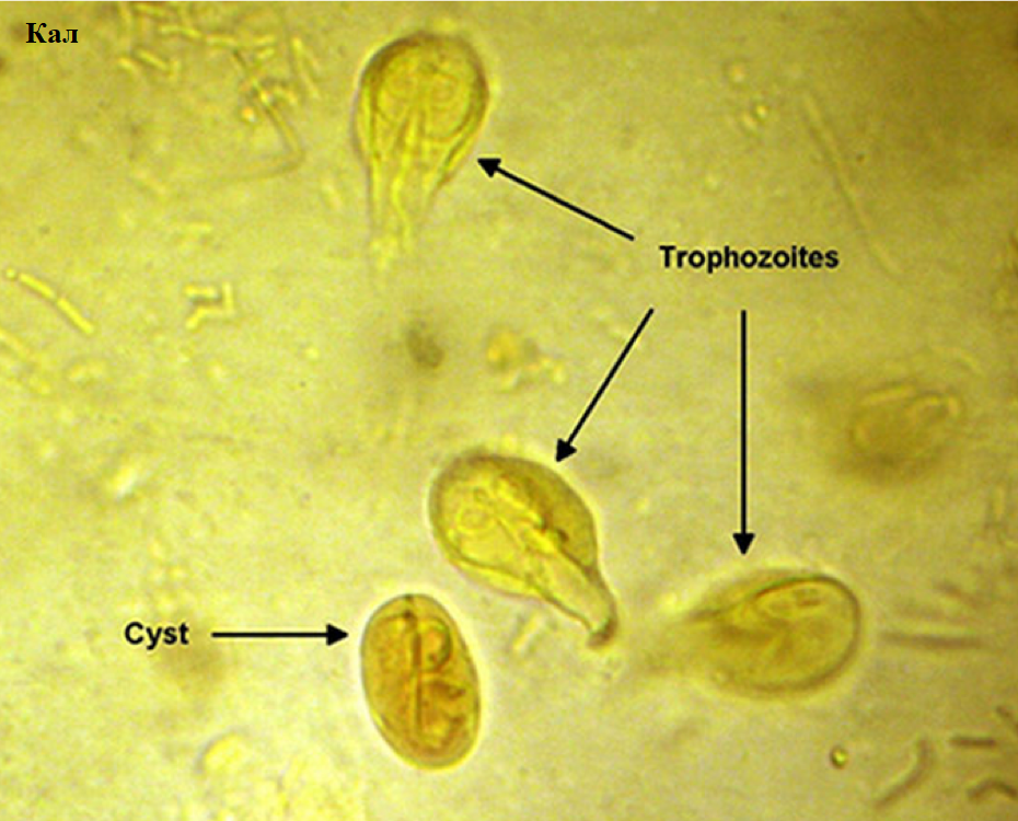 Циста лямблии под микроскопом. Микроскопия кала яйца гельминтов. Цисты лямблий микроскопия кала. Споры в кале у взрослого