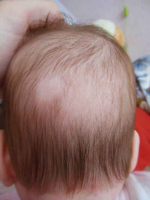 Уход за волосами  новорожденного
