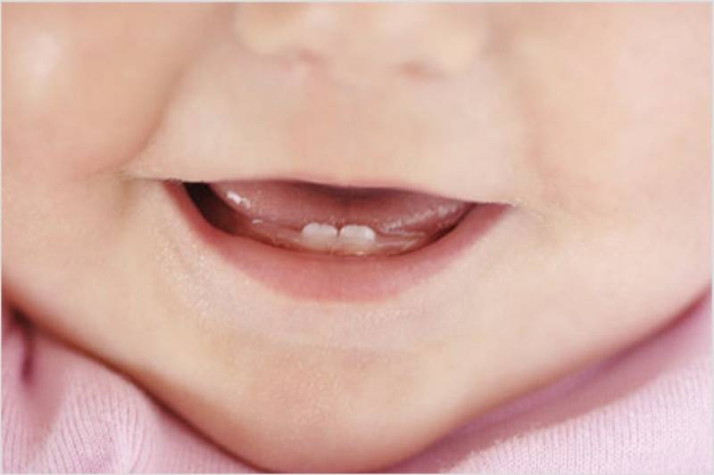 Схема прорезывания молочных зубов в материале экспертного журнала startsmile