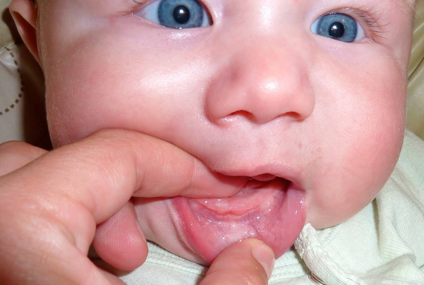 Прорезывание зубов у детей до года: порядок, сроки | последовательность прорезывания молочных зубов у грудничка