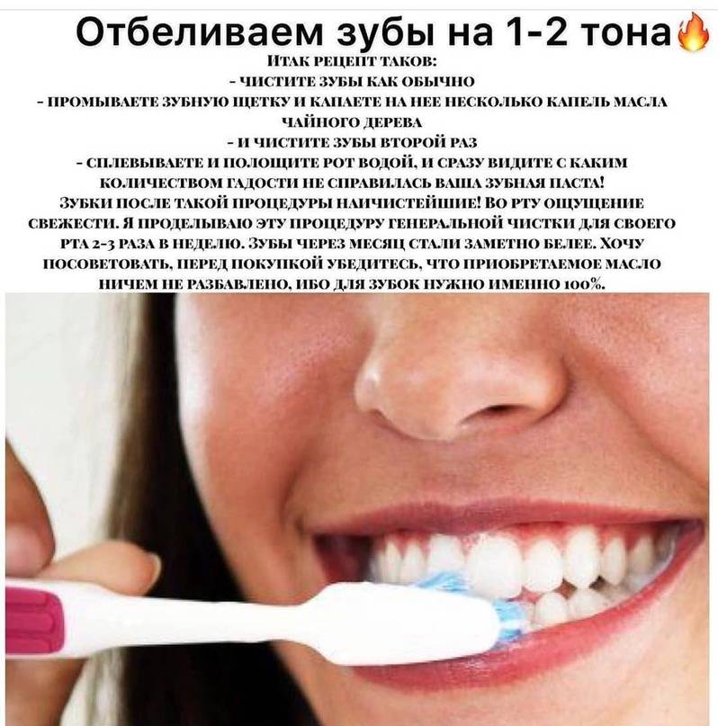 Отбеливание зубов при беременности - можно ли отбеливать зубы беременным женщинам