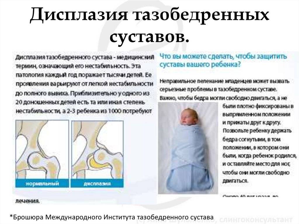Узи тазобедренных суставов у детей до 1 года (александров) | парацельс