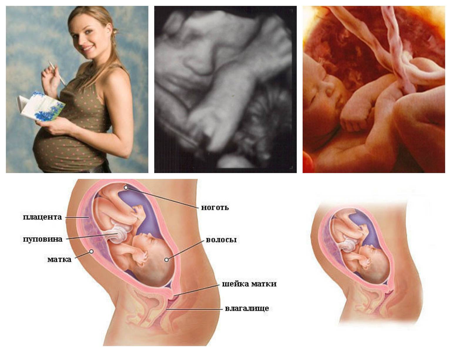 Протекание беременности на 32 неделе — состояние здоровья мамы и малыша