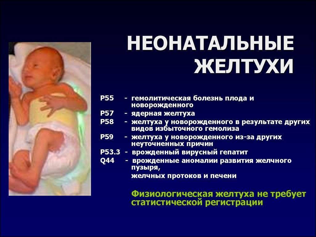 Лечение желтушки у новорожденных