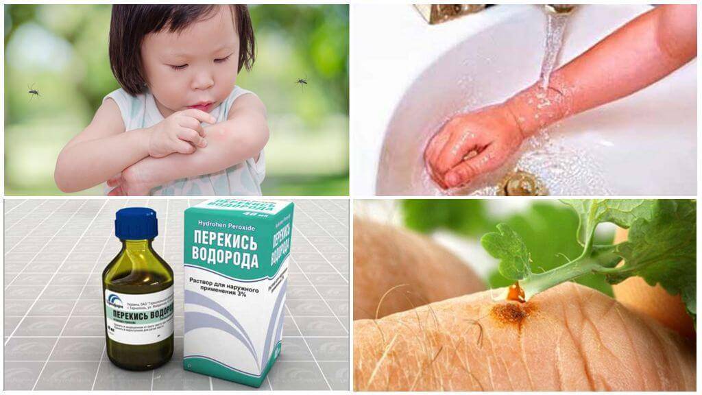 Как защитить ребенка от клещей, комаров и других насекомых. какие средства от насекомых эффективные