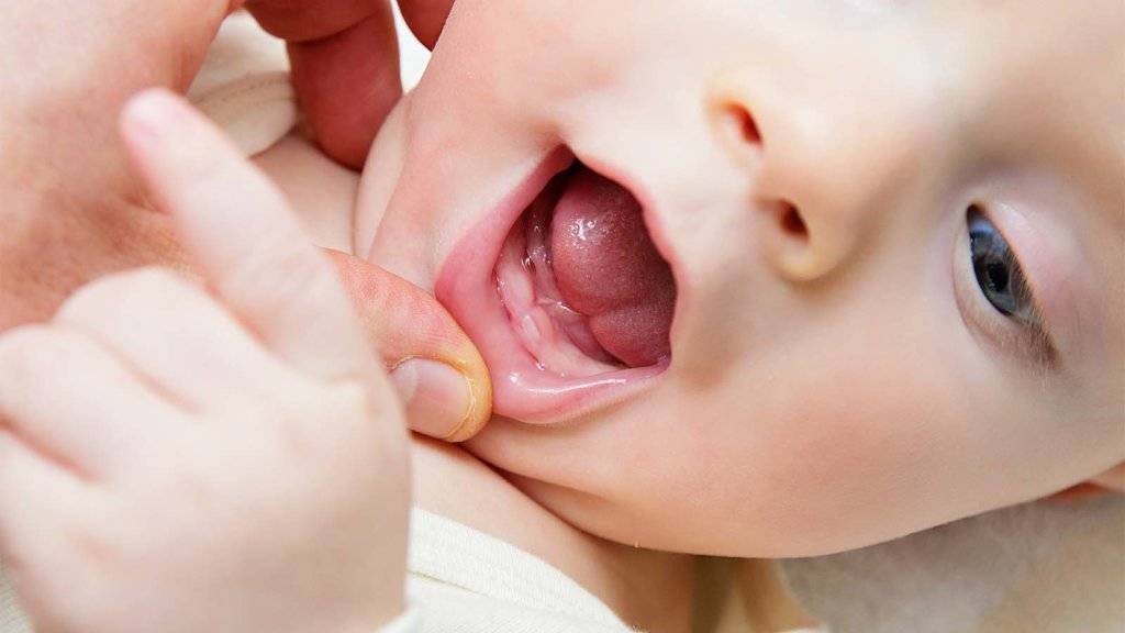 Фиброма десны, губ, щек и слизистых оболочек полости рта: может ли нарост на нижней и верхней челюстях рассосаться сам – лечение зубов с фото