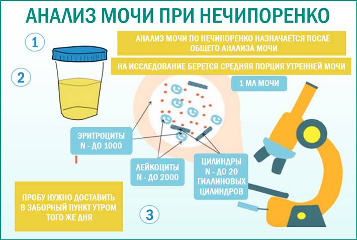 Сколько мочи необходимо для анализа грудничка