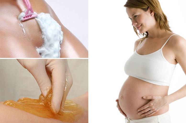 Шугаринг при беременности – не вредит ли плоду? (1, 2 и 3 триместр)