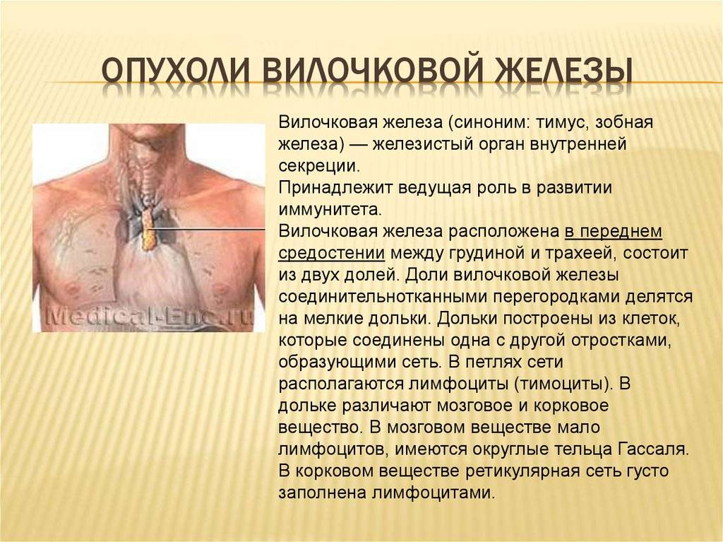 Реберный хондрит (синдром титце) - лечение, симптомы, причины, диагностика | центр дикуля