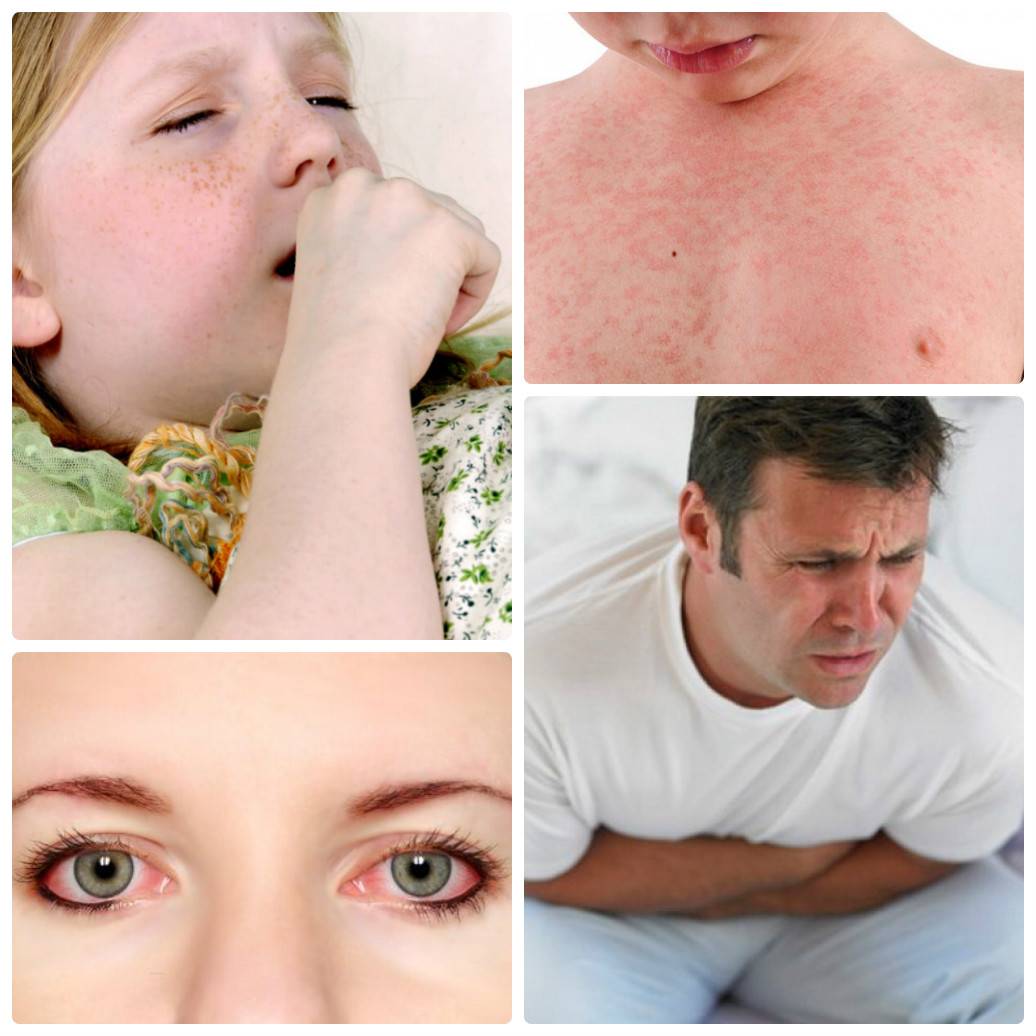 Аллергия на пыль: причины, симптомы, лечение