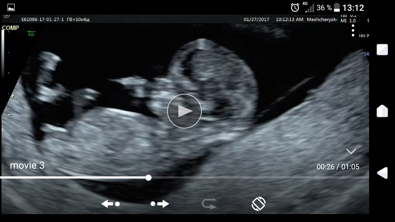 Скрининговое 3д узи при беременности: главный герой фильма 3d— ваш малыш!