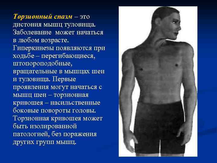 Спастическая кривошея - лечение, симптомы, причины, диагностика | центр дикуля
