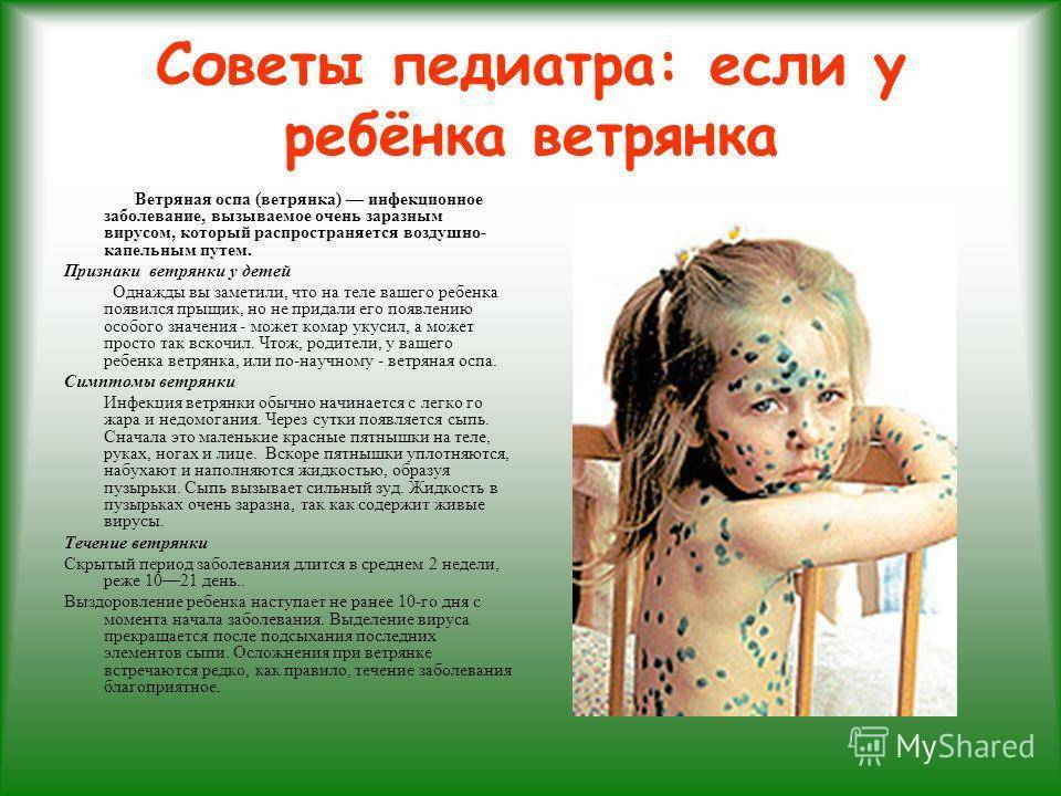 Ветряная оспа у детей - симптомы болезни, профилактика и лечение ветряной оспы у детей, причины заболевания и его диагностика на eurolab