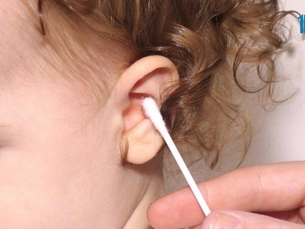 Серная ушная пробка у ребенка