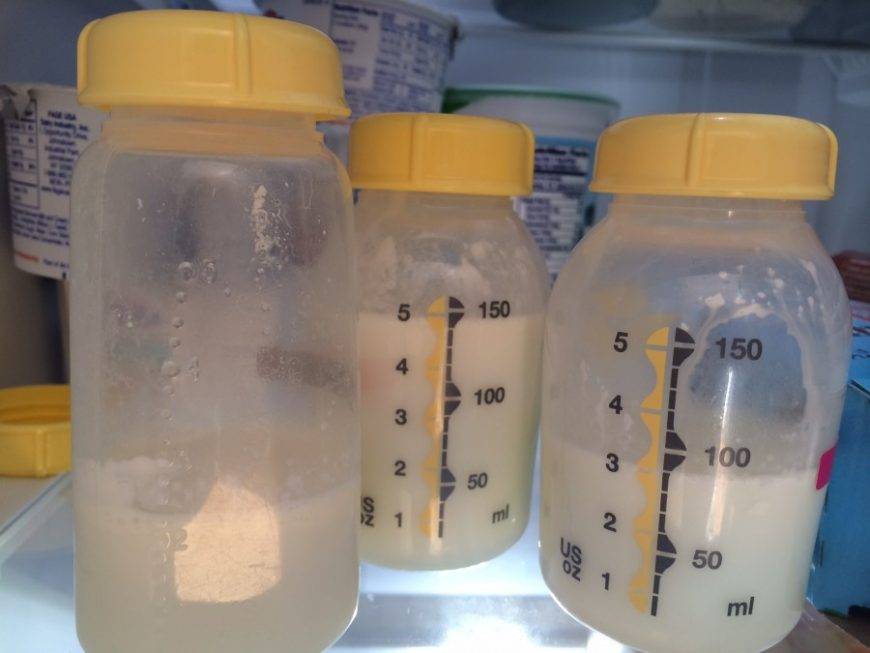 Почему грудное молоко жидкое, как вода, и стоит ли переживать об этом?