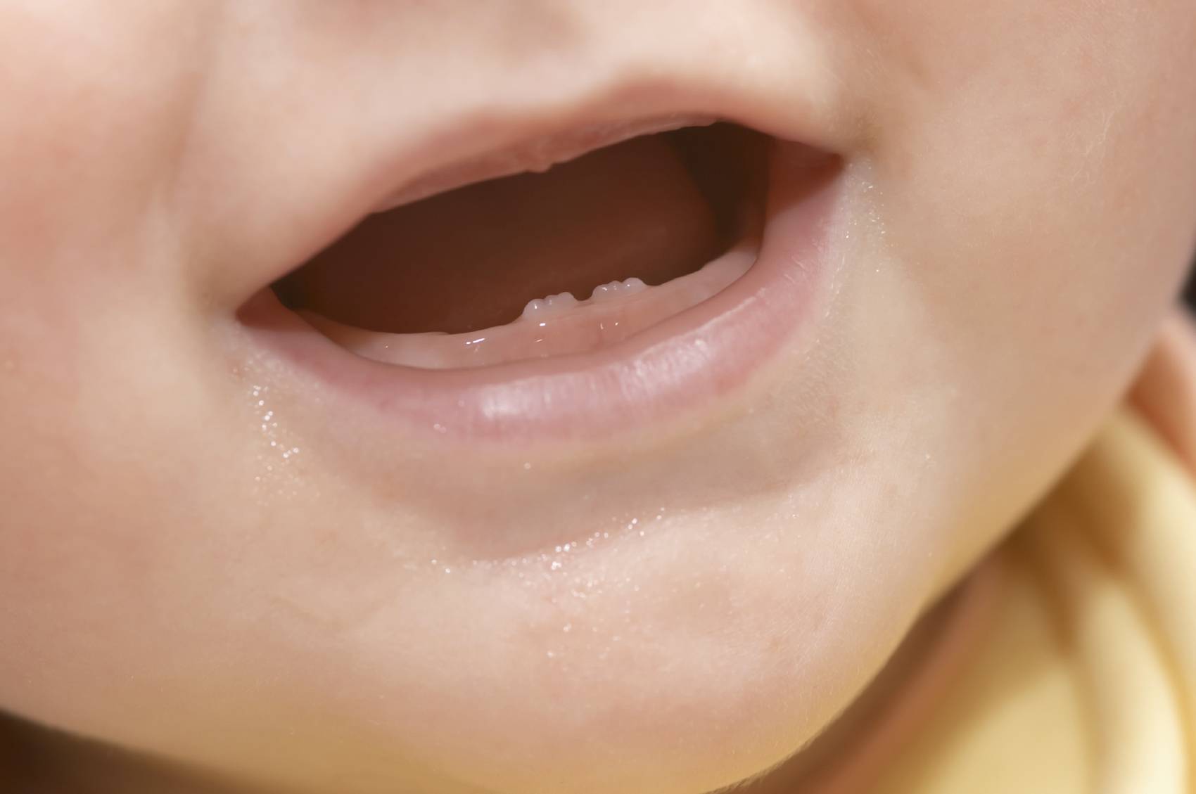 Прорезывание зубов: когда может потребоваться помощь врача?