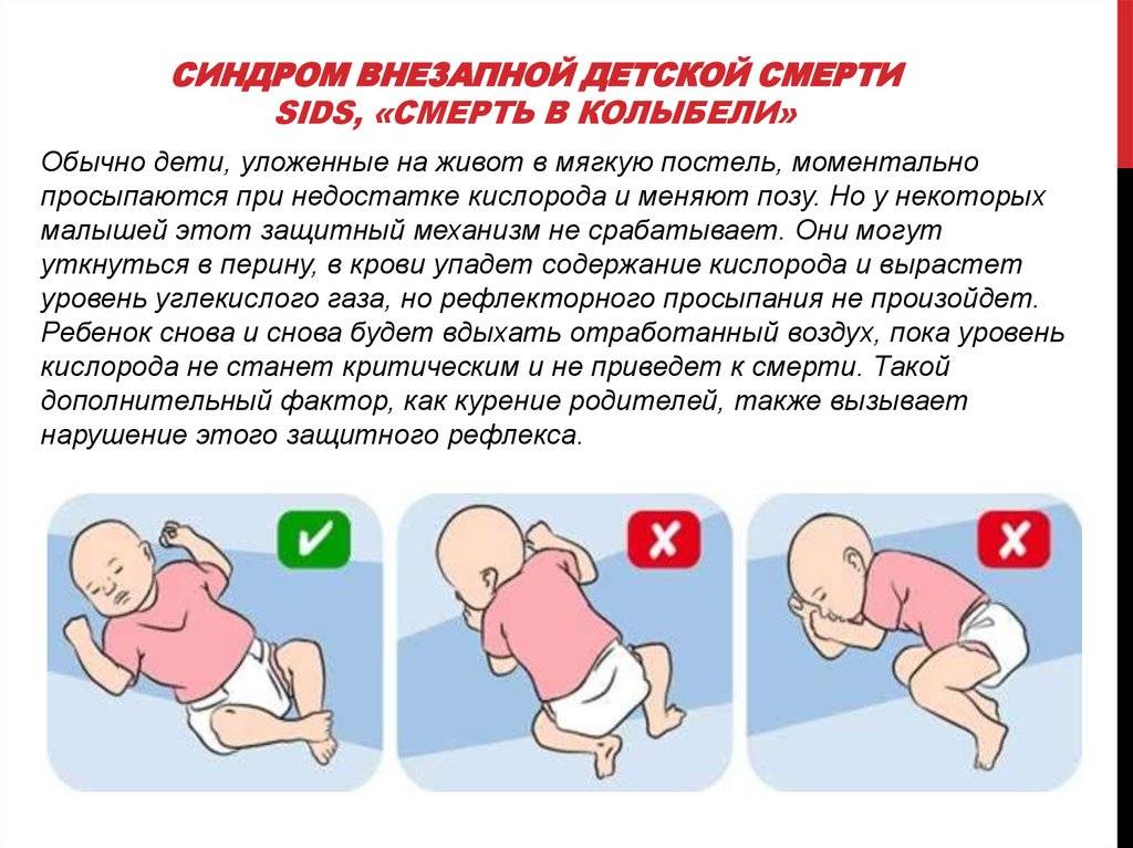 Синдром внезапной детской смерти: причины, до какого возраста - medside.ru