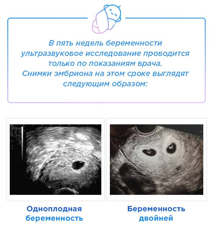 5 неделя беременности: фото плода, что происходит, выделения, признаки, узи