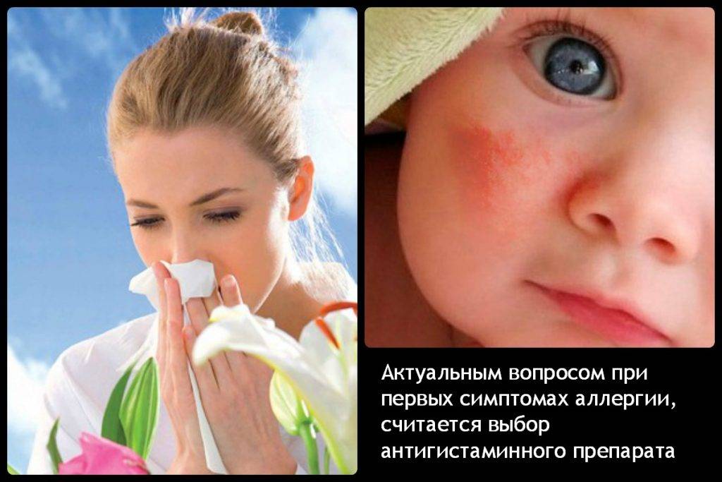 Аллергия на пыль у ребенка фото