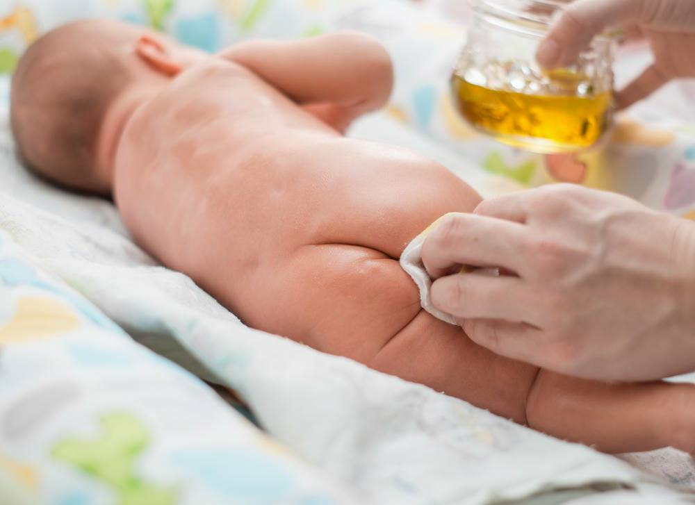 Чем лечить пеленочный дерматит у детей: кремы и мази от раздражения от подгузников