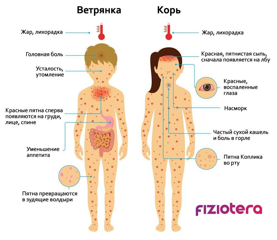 Ветрянка у детей информация картинки симптомы начало и лечение фото описание