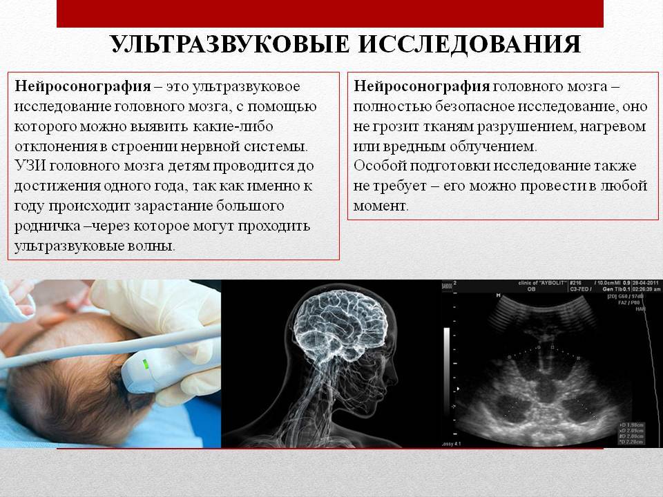 Узи головного мозга у новорожденных фото