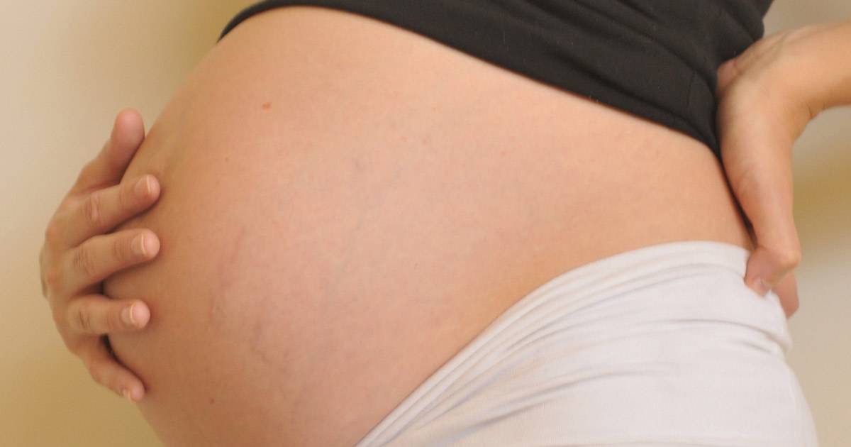 Опасно ли скопление газов во время беременности?