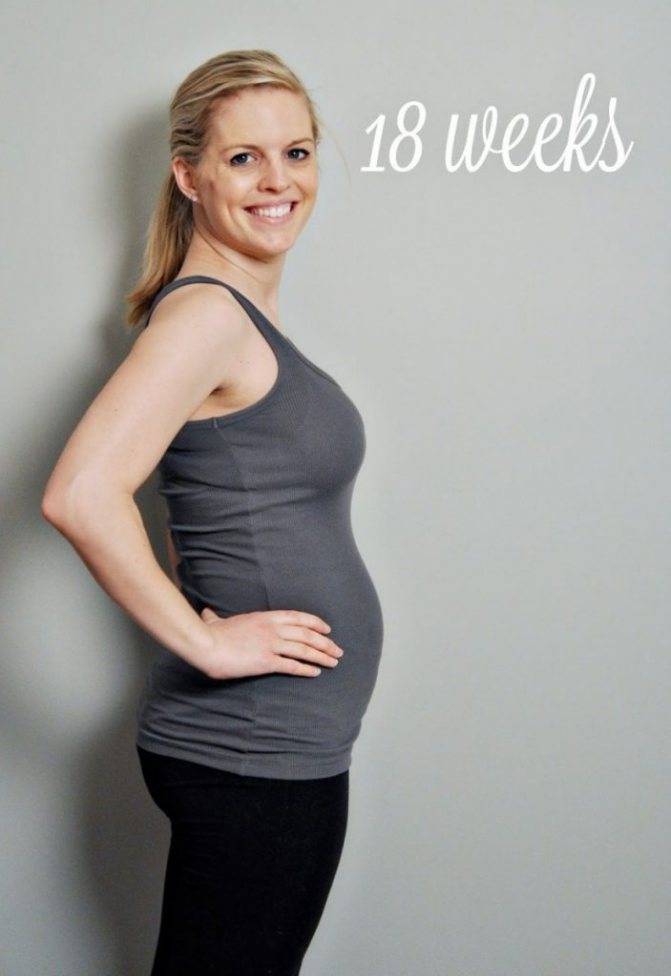 Ковид во время беременности: симптомы и последствия