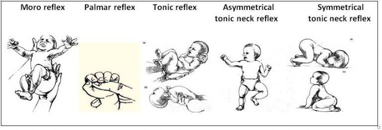Рефлекс моро — особенности проверки реакции испуга у новорожденных