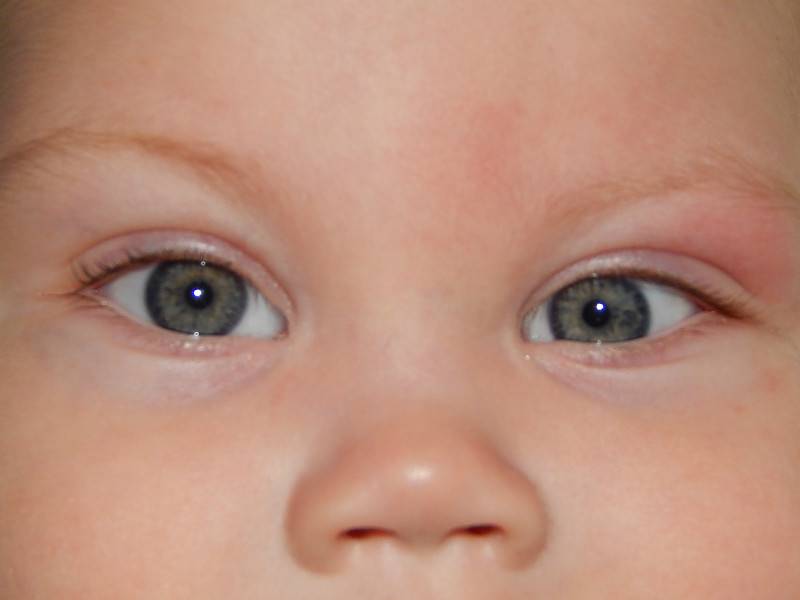 Формирование зрения у новорожденных детей