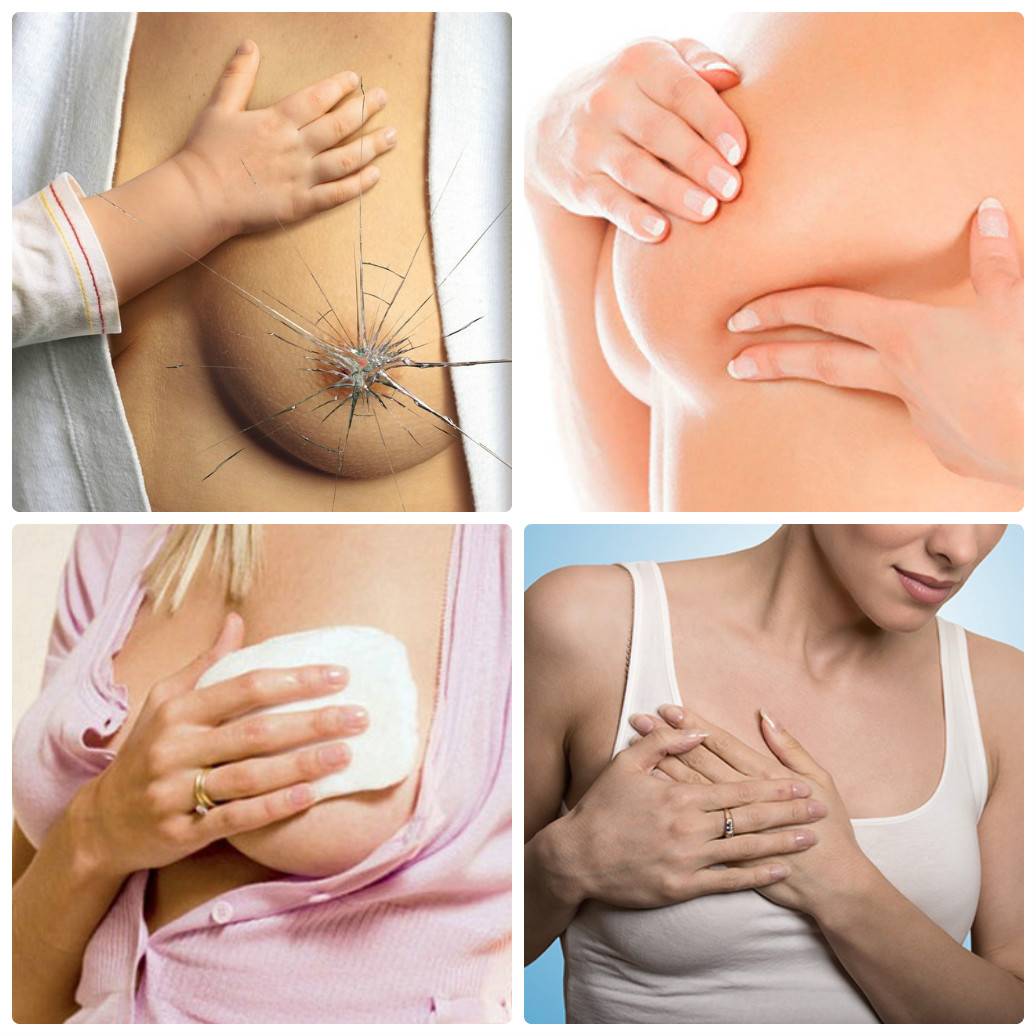 Обвисшая грудь (птоз): заболевание или норма? | клиника в уручье