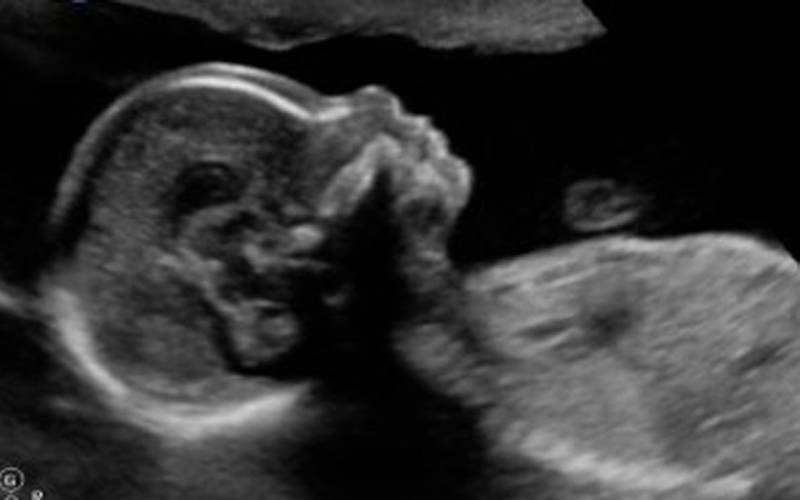 Узи в третьем триместре беременности: цели, нормы, интерпретация