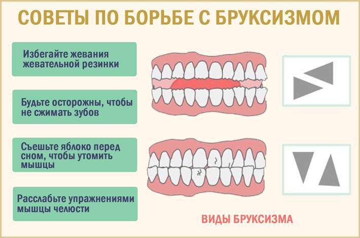 Почему взрослые скрипят зубами - основные причины