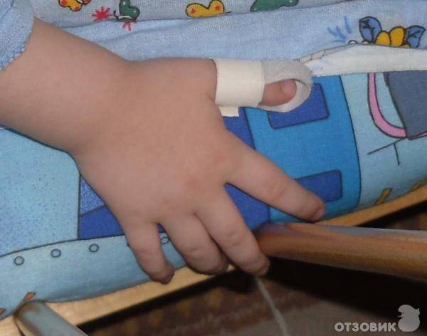 Отучаем малыша сосать палец
