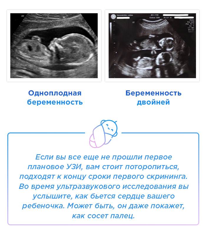 Признаки беременности двойней и развитие плодов по неделям, ощущения матери
