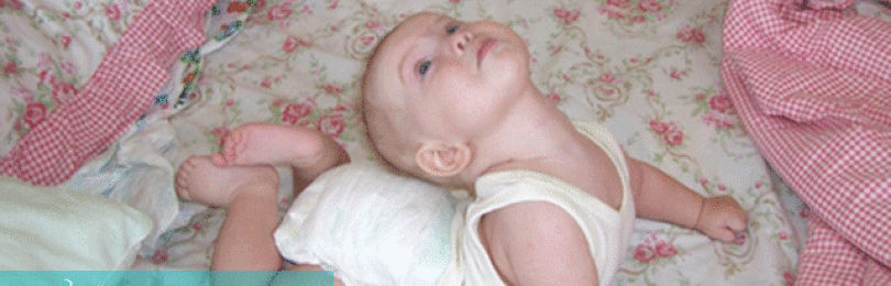 Новорожденный ребенок запрокидывает голову назад: как лечить?