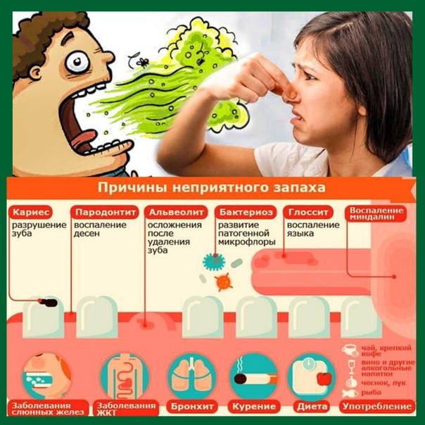 Почему у ребенка плохо пахнет изо рта?