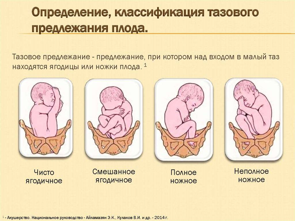 Когда перевернулся ребенок из косого предлежания