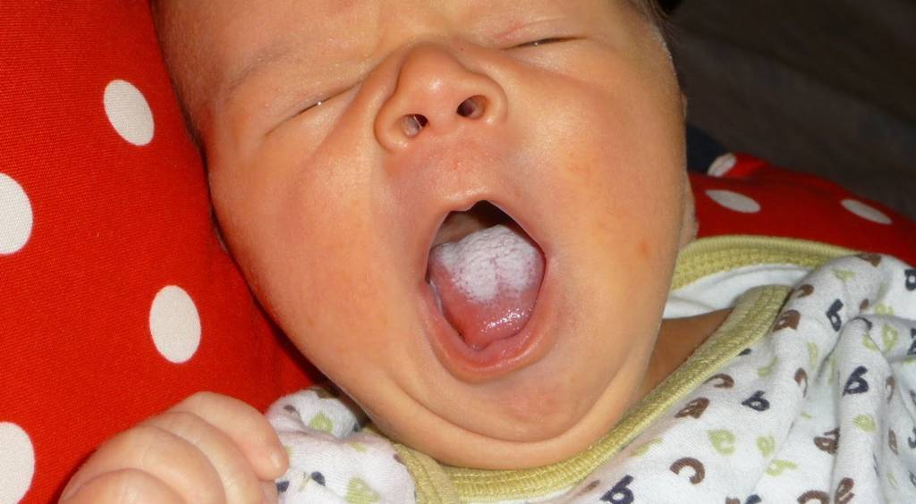 Новорожденный высовывает язык: основные причины для беспокойства