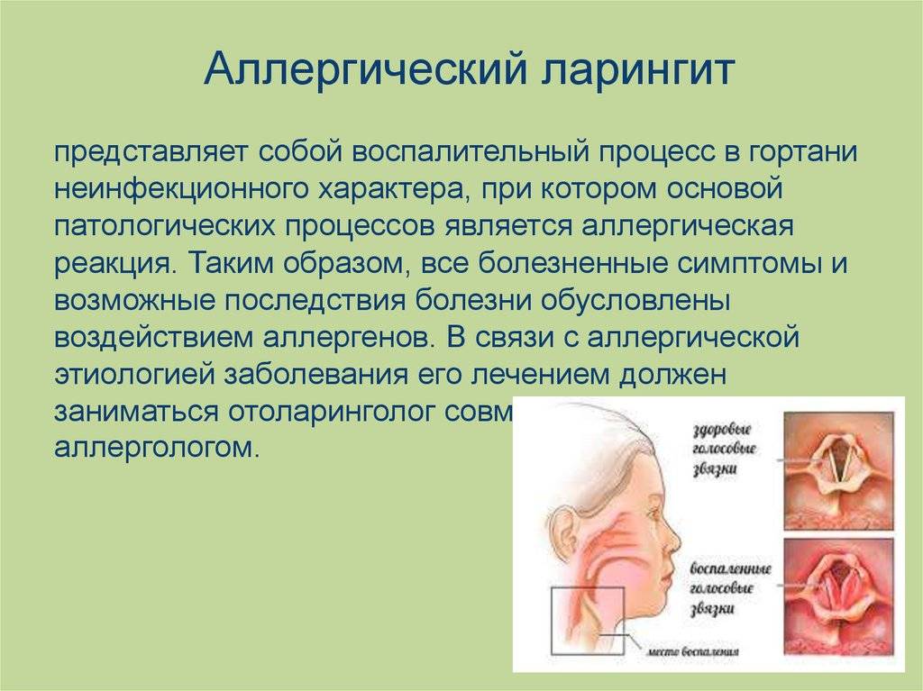 Ларингит у детей: симптомы и лечение - medside.ru