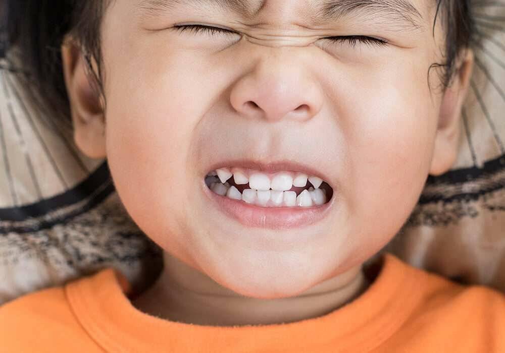 Бруксизм у детей (скрежет зубами) — причины и лечение (капами) в детской стоматологии дентал фэнтези