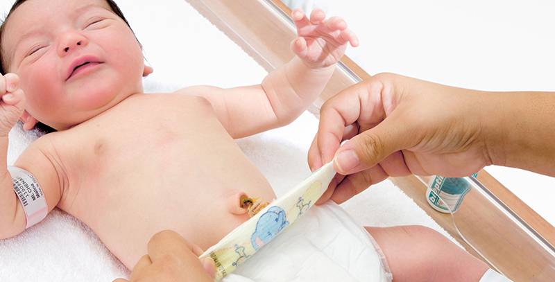 7 незамедлительных действий, если кровит пупок у новорождённого, от врача-неонатолога