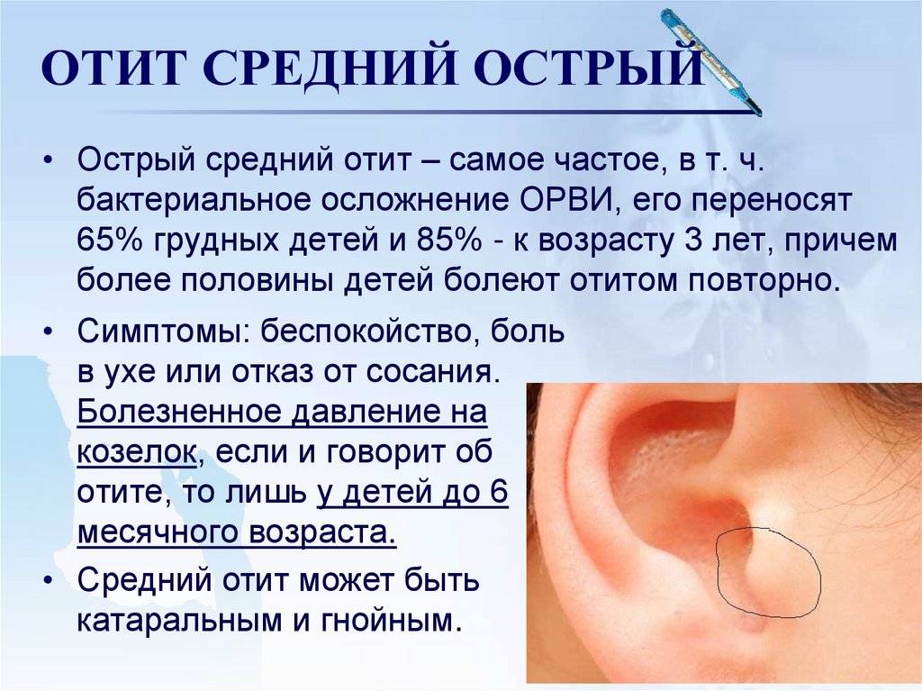 Отит – основная причина боли в ухе. симптомы, возможные осложнения и лечение отита.