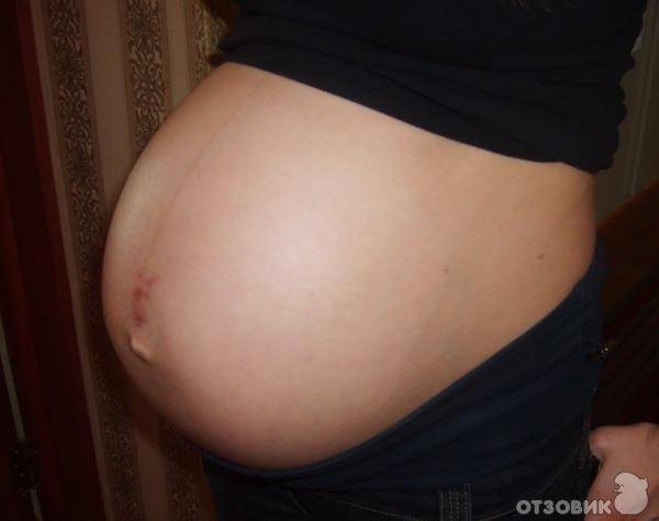 Пупок при беременности – как изменяется и почему?