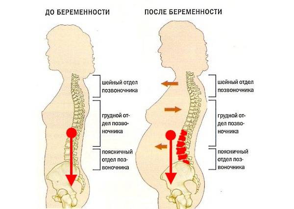 Болит спина при беременности: диагностика и лечение в киеве