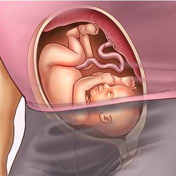 Почему ребенок икает в животе у беременной - детская городская поликлиника №1 г. магнитогорска